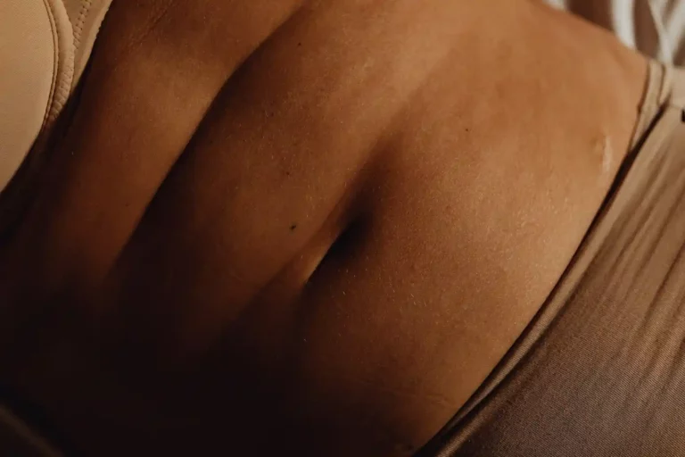 Acide hyaluronique cicatrice (1)